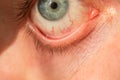 The manÃ¢â¬â¢s eye is gray-blue with red veins on it very close